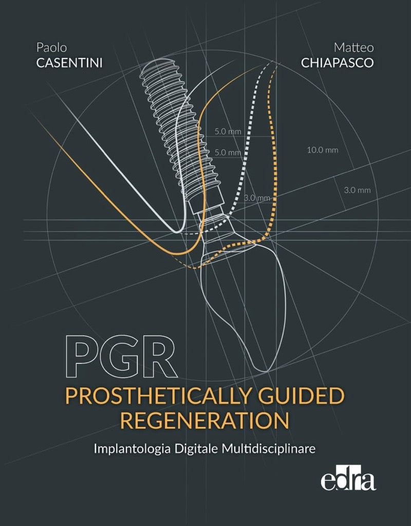 PGR - Prosthetically Guided Regeneration - Implantologia Digitale Multidisciplinare