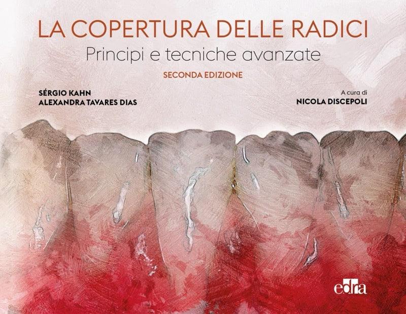 La copertura delle radici - Principi e tecniche avanzate