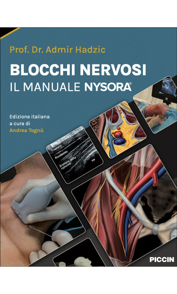 Blocchi nervosi - Il manuale Nysora©