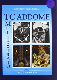 TC ( Tomografia Computerizzata ) Multistrato Addome