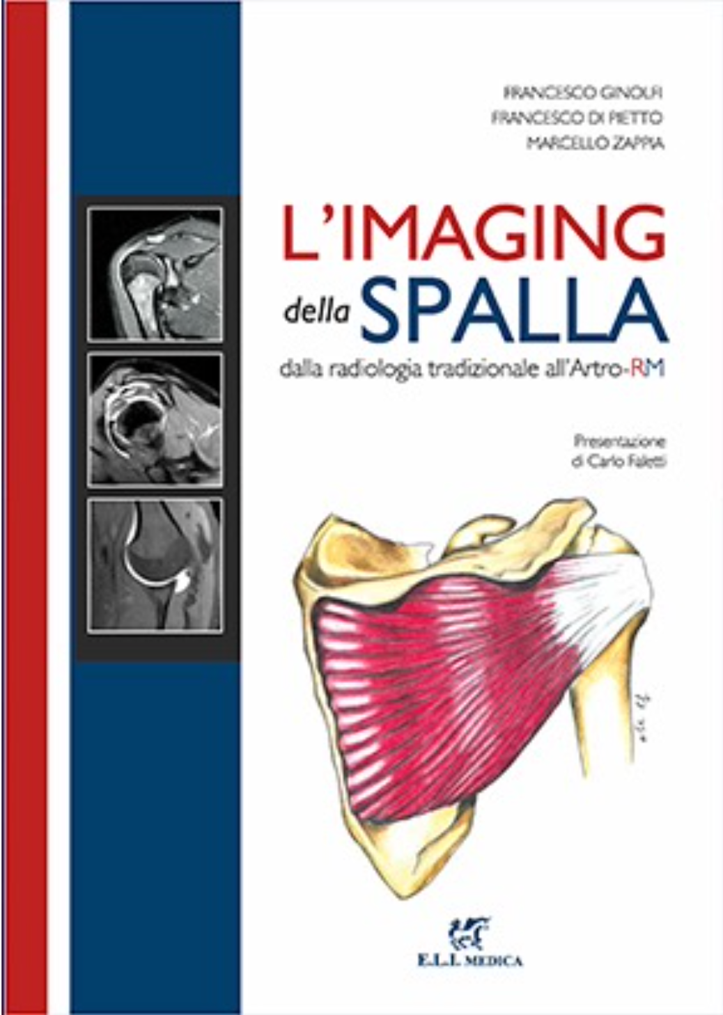 L'imaging della spalla - Dalla radiologia tradizionela all' Artro - RM