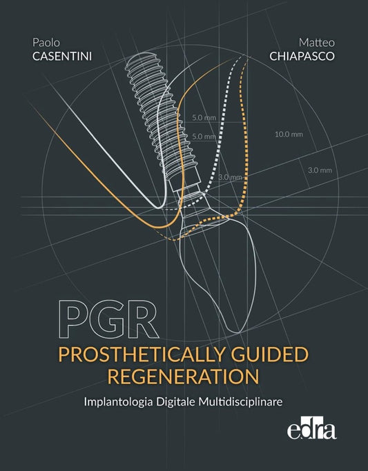 PGR - Prosthetically Guided Regeneration - Implantologia Digitale Multidisciplinare