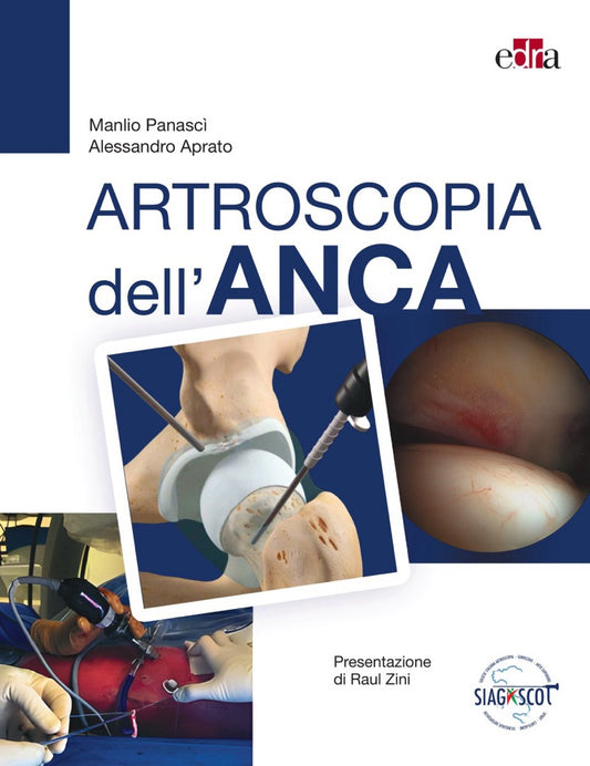 Artroscopia dell' anca