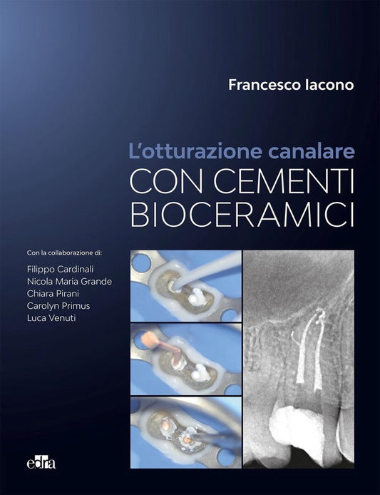L' otturazione canalare con i cementi bioceramici