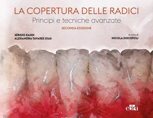 La copertura delle radici - Principi e tecniche avanzate