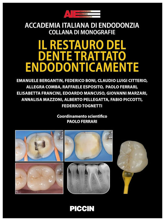 Il restauro del dente trattato endodonticamente