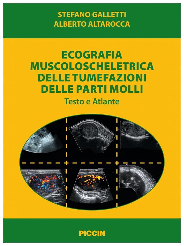 Ecografia muscoloscheletrica delle tumefazioni delle parti molli