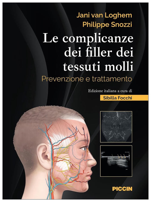 Le complicanze dei filler dei tessuti molli - Prevenzione e trattamento