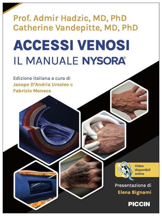 Accessi venosi - Il manuale Nysora©