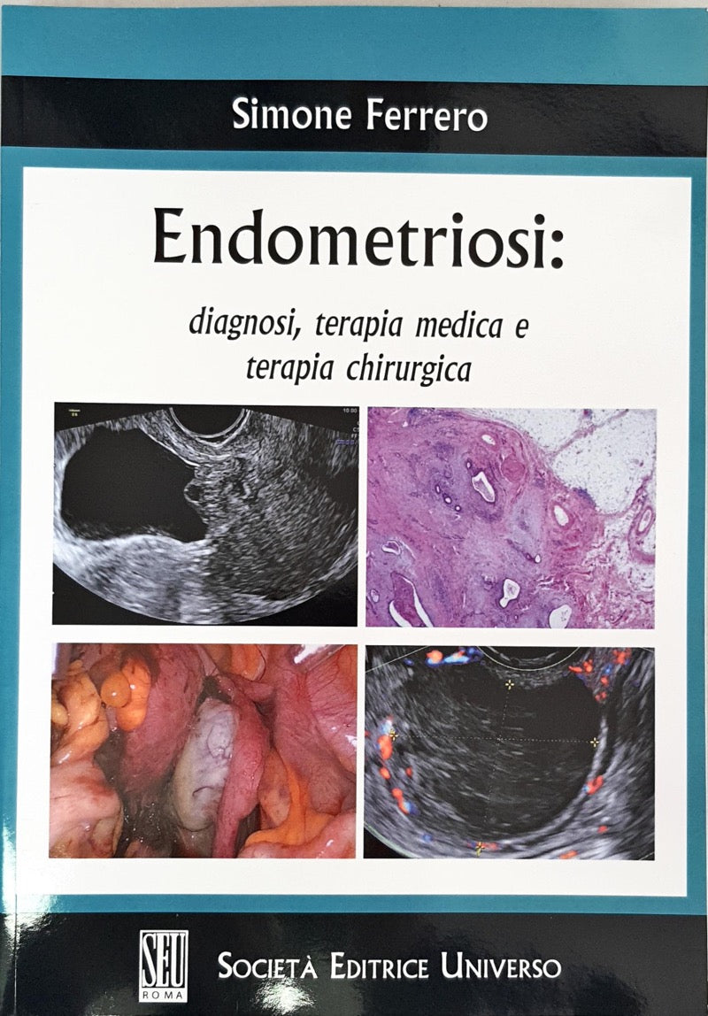 Endometriosi : diagnosi , terapia medica e terapia chirurgica