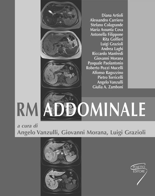 RM ( risonanza magnetica ) addominale