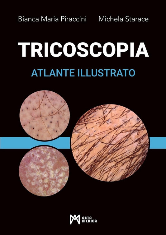 Tricoscopia - Atlante illustrato