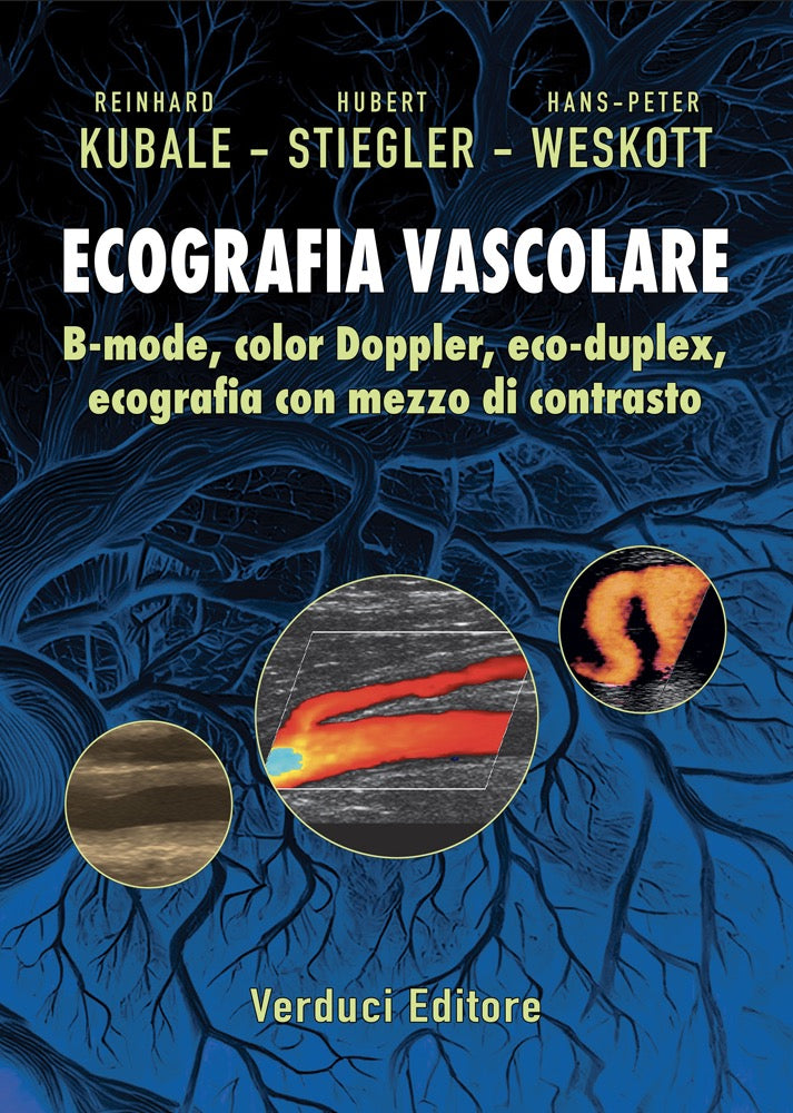 Ecografia Vascolare. B - mode, color Doppler, eco - duplex, ecografia con mezzo di contrasto