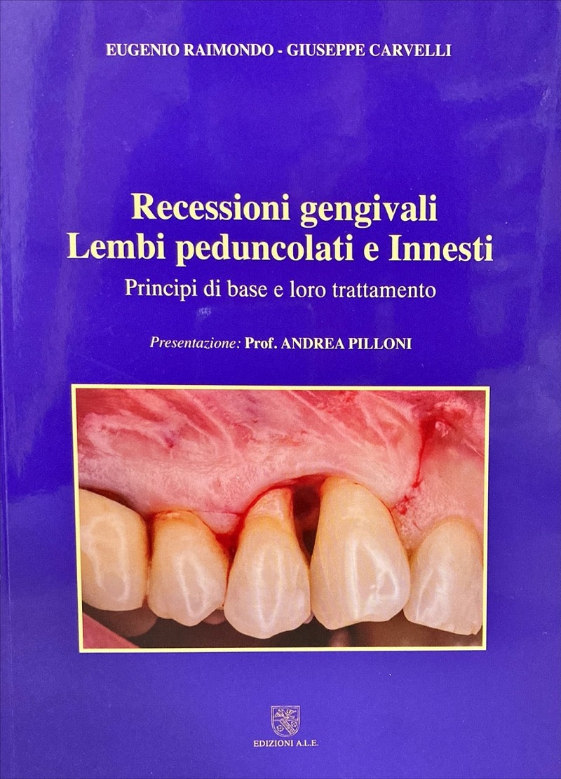 Recessioni gengivali Lembi peduncolati e Innesti - Principi di base e loro trattamento