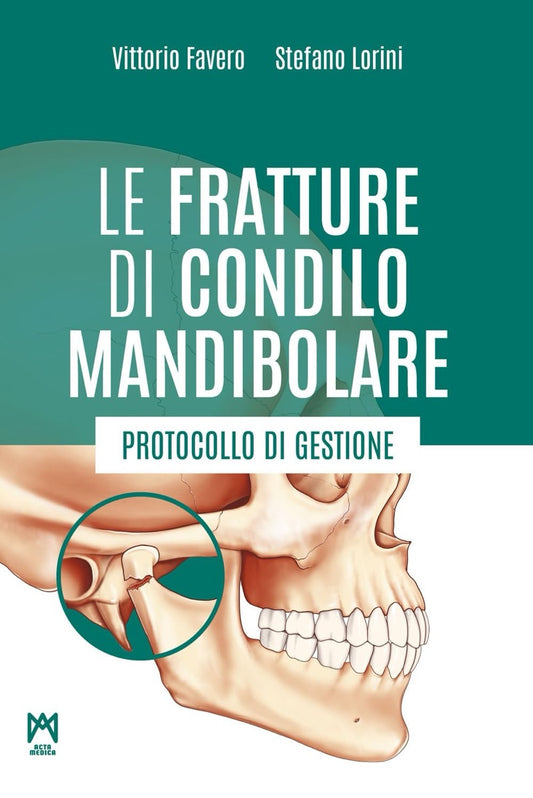 Le fratture di condilo mandibolare - Protocollo di gestione