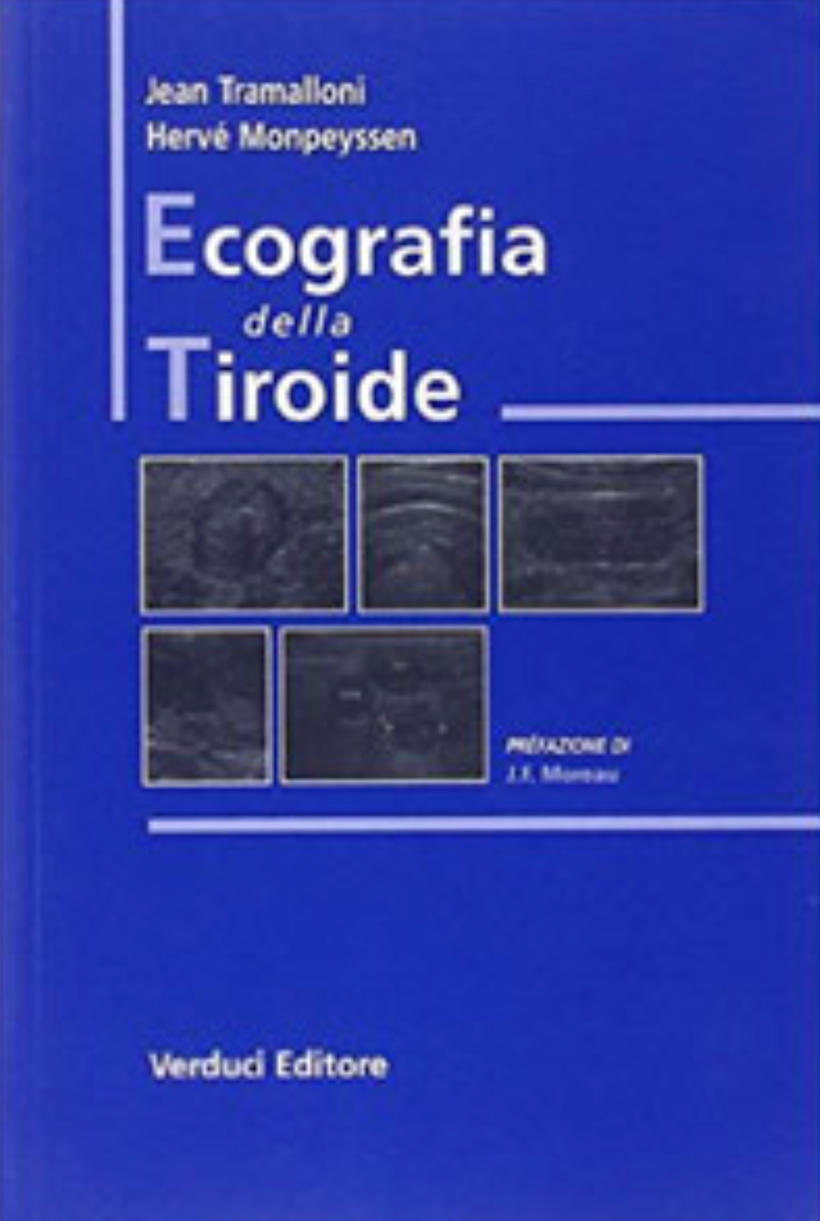 Ecografia della tiroide